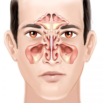 Área afetada pela sinusite (Foto: reprodução)